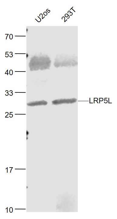 Lane 1: Human U-2OS cell lysates; Lane 2: Human 293T cell lysates probed with LRP5L Polyclonal Antibody, Unconjugated (bs-11590R) at 1:1000 dilution and 4˚C overnight incubation. Followed by conjugated secondary antibody incubation at 1:20000 for 60 min at 37˚C.