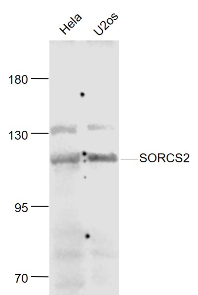 Lane 1: Human Hela cell lysates; Lane 2: Human U-2OS cell lysates probed with SORCS2 Polyclonal Antibody, Unconjugated (bs-11963R) at 1:1000 dilution and 4˚C overnight incubation. Followed by conjugated secondary antibody incubation at 1:20000 for 60 min at 37˚C.