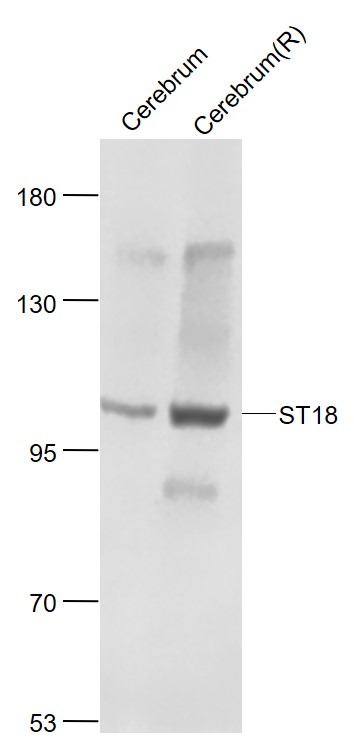 Lane 1: Mouse Cerebrum lysates; Lane 2: Rat Cerebrum lysates probed withST18/Znf387 Polyclonal Antibody, Unconjugated (bs-12188R) at 1:1000 dilution and 4˚C overnight incubation. Followed by conjugated secondary antibody incubation at 1:20000 for 60 min at 37˚C.