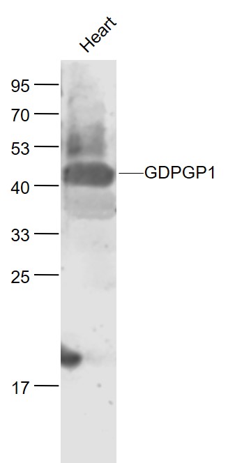 Lane 1: Mouse Heart lysates probed with GDPGP1/C15orf58 Polyclonal Antibody, Unconjugated (bs-13326R) at 1:1000 dilution and 4˚C overnight incubation. Followed by conjugated secondary antibody incubation at 1:20000 for 60 min at 37˚C.