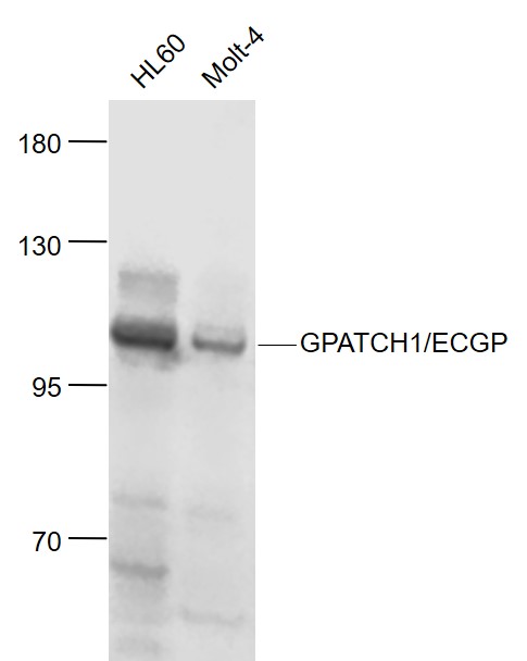 Lane 1: Human HL-60 cell lysates; Lane 2: Human MOLT-4 cell lysates probed with GPATCH1/ECGP Polyclonal Antibody, Unconjugated (bs-13498R) at 1:1000 dilution and 4˚C overnight incubation. Followed by conjugated secondary antibody incubation at 1:20000 for 60 min at 37˚C.