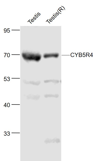 Lane 1: Mouse Testis lysates; Lane 2: Rat Testis lysates probed with CYB5R4 Polyclonal Antibody, Unconjugated (bs-14133R) at 1:1000 dilution and 4˚C overnight incubation. Followed by conjugated secondary antibody incubation at 1:20000 for 60 min at 37˚C.