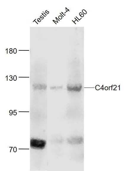 Lane 1: Mouse Testis cell lysates; Lane 2: Human MOLT-4 cell lysates; Lane 3: Human HL-60 cell lysates probed with C4orf21 Polyclonal Antibody, Unconjugated (bs-15188R) at 1:1000 dilution and 4˚C overnight incubation. Followed by conjugated secondary antibody incubation at 1:20000 for 60 min at 37˚C.