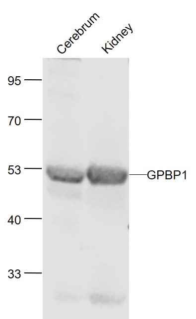 Lane 1: Mouse Cerebrum lysates; Lane 2: Mouse Kidney lysates probed with GPBP1/Vasculin Polyclonal Antibody, Unconjugated (bs-13503R) at 1:1000 dilution and 4˚C overnight incubation. Followed by conjugated secondary antibody incubation at 1:20000 for 60 min at 37˚C.