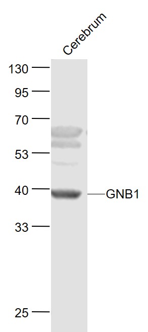 Lane 1: Mouse Cerebrum lysates probed with G protein beta Polyclonal Antibody, Unconjugated (bs-0348R) at 1:1000 dilution and 4˚C overnight incubation. Followed by conjugated secondary antibody incubation at 1:20000 for 60 min at 37˚C.