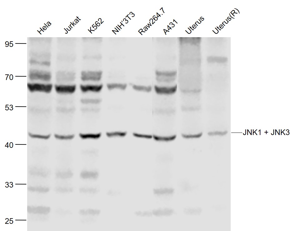 Lane 1: Human Hela cell lysates; Lane 2: Human Jurkat cell lysates; Lane 3: Human K562 cell lysates; Lane 4: Mouse NIH/3T3 cell lysates; Lane 5: Mouse RAW264.7 cell lysates; Lane 6: Human A431 cell lysates; Lane 7: Mouse Uterus lysates; Lane 8: Rat Uterus lysates probed with JNK1 + 3 Polyclonal Antibody, Unconjugated (bs-0501R) at 1:1000 dilution and 4˚C overnight incubation. Followed by conjugated secondary antibody incubation at 1:20000 for 60 min at 37˚C.