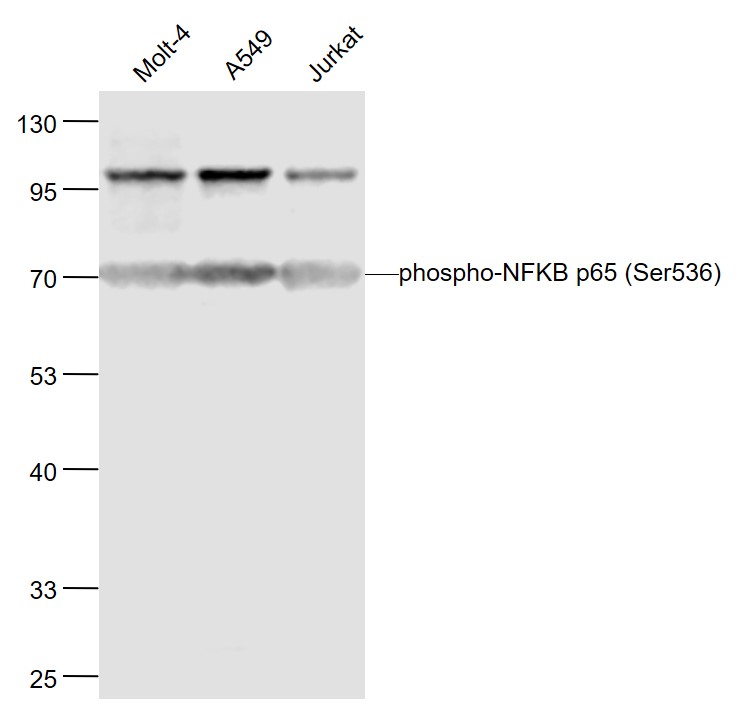 Lane 1: Human MOLT-4 cell lysates; Lane 2: Human A549 cell lysates; Lane 3: Human Jurkat cell lysates probed with NFKB p65 Polyclonal Antibody, Unconjugated (bs-0982R) at 1:1000 dilution and 4˚C overnight incubation. Followed by conjugated secondary antibody incubation at 1:20000 for 60 min at 37˚C.