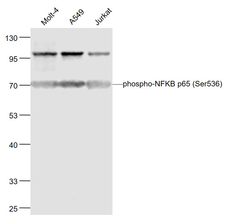 Recombinant Anti-NF-kB p65 antibody [E379] KO Tested (ab32536)