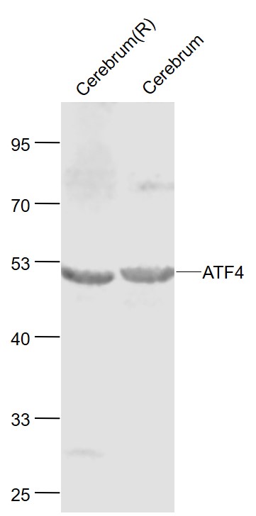 Lane 1: Rat Cerebrum lysates; Lane 2: Mouse Cerebrum lysates probed with ATF4\/CREB-2 Polyclonal Antibody, Unconjugated (bs-1531R) at 1:1000 dilution and 4˚C overnight incubation. Followed by conjugated secondary antibody incubation at 1:20000 for 60 min at 37˚C.
