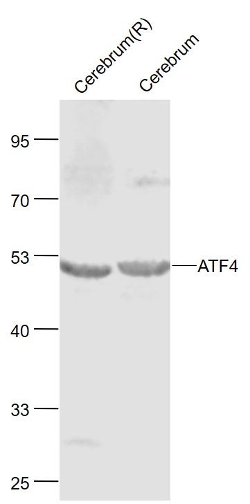 Lane 1: Rat Cerebrum lysates; Lane 2: Mouse Cerebrum lysates probed with ATF4/CREB-2 Polyclonal Antibody, Unconjugated (bs-1531R) at 1:1000 dilution and 4˚C overnight incubation. Followed by conjugated secondary antibody incubation at 1:20000 for 60 min at 37˚C.