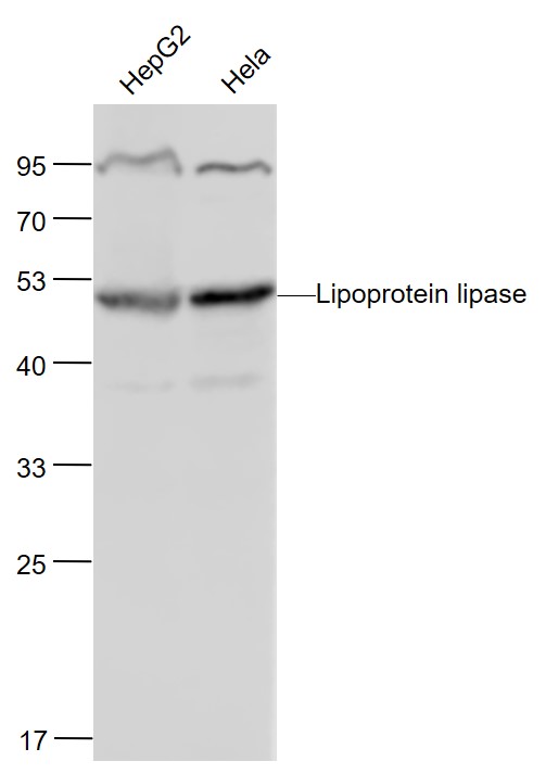 Lane 1: Human HepG2 cell lysates; Lane 2: Human Hela cell lysates probed with LPL Polyclonal Antibody, Unconjugated (bs-1973R) at 1:1000 dilution and 4˚C overnight incubation. Followed by conjugated secondary antibody incubation at 1:20000 for 60 min at 37˚C._x000D_