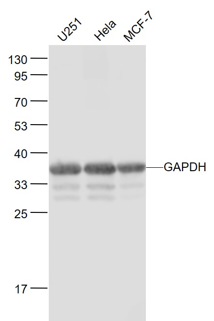 Lane 1: Human U251 cell lysates; Lane 2: Human Hela cell lysates; Lane 3: Human MCF-7 cell lysates probed with GAPDH Polyclonal Antibody, Unconjugated (bs-2188R) at 1:1000 dilution and 4˚C overnight incubation. Followed by conjugated secondary antibody incubation at 1:20000 for 60 min at 37˚C