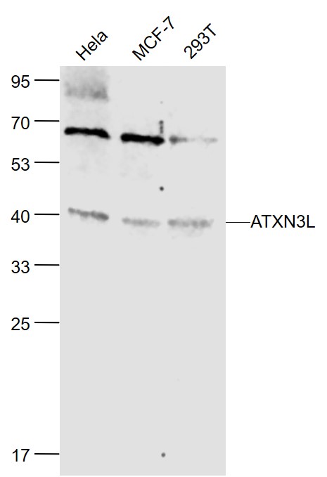 Lane 1: Human Hela cell lysates; Lane 2: Human MCF-7 cell lysates; Lane 3: Human 293T cell lysates probed with ATXN3L Polyclonal Antibody, Unconjugated (bs-4807R) at 1:1000 dilution and 4˚C overnight incubation. Followed by conjugated secondary antibody incubation at 1:20000 for 60 min at 37˚C.