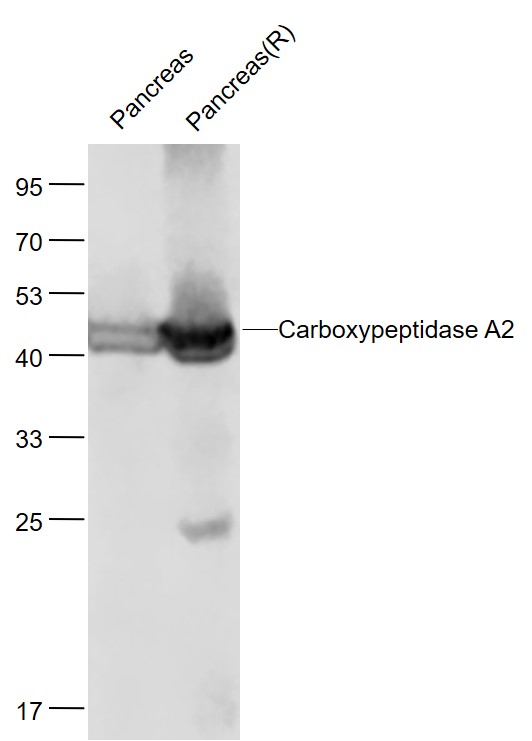Lane 1: Mouse Pancreas lysates; Lane 2: Rat Pancreas lysates probed with Carboxypeptidase A2 Polyclonal Antibody, Unconjugated (bs-6035R) at 1:1000 dilution and 4˚C overnight incubation. Followed by conjugated secondary antibody incubation at 1:20000 for 60 min at 37˚C