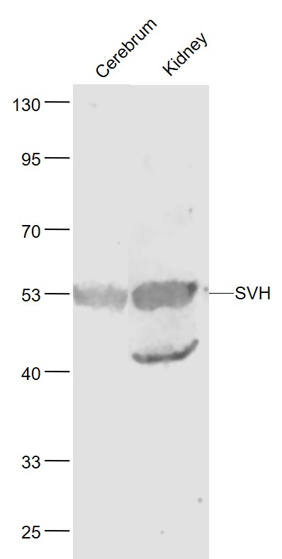 Lane 1: Mouse Cerebrum lysates; Lane 2: Mouse Kidney lysates probed with SVH Polyclonal Antibody, Unconjugated (bs-6737R) at 1:1000 dilution and 4˚C overnight incubation. Followed by conjugated secondary antibody incubation at 1:20000 for 60 min at 37˚C.