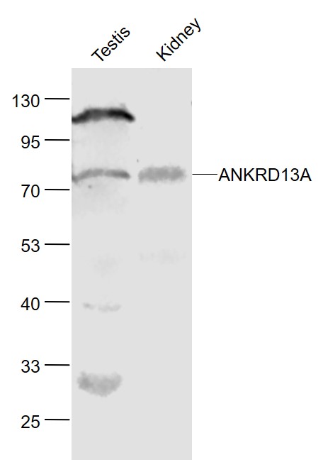 Lane 1: Mouse Testis lysates; Lane 2: Mouse Kidney lysates probed with ANKRD13A Polyclonal Antibody, Unconjugated (bs-7963R) at 1:1000 dilution and 4˚C overnight incubation. Followed by conjugated secondary antibody incubation at 1:20000 for 60 min at 37˚C
