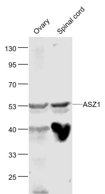 Lane 1: Mouse Ovary lysates; Lane 2: Mouse Spinal cord lysates probed with ASZ1 Polyclonal Antibody, Unconjugated (bs-9325R) at 1:1000 dilution and 4˚C overnight incubation. Followed by conjugated secondary antibody incubation at 1:20000 for 60 min at 37˚C