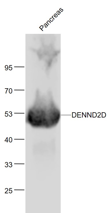 Lane 1: Mouse Pancreas lysates probed with DENND2D Polyclonal Antibody, Unconjugated (bs-9668R) at 1:1000 dilution and 4˚C overnight incubation. Followed by conjugated secondary antibody incubation at 1:20000 for 60 min at 37˚C.