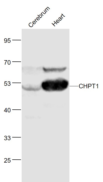Lane 1: Mouse Cerebrum lysates; Lane 2: Mouse Heart lysates probed with CHPT1 Polyclonal Antibody, Unconjugated (bs-9725R) at 1:1000 dilution and 4˚C overnight incubation. Followed by conjugated secondary antibody incubation at 1:20000 for 60 min at 37˚C.