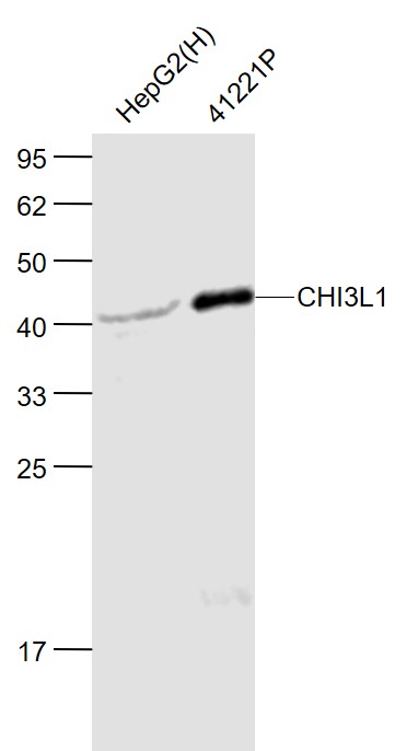 Lane 1: Human HepG2 cell lysates; Lane 2: Recombinant human CHI3L1 Protein (bs-41221P) lysates probed with CHI3L1 Polyclonal Antibody, Unconjugated (bs-10215R) at 1:1000 dilution and 4˚C overnight incubation. Followed by conjugated secondary antibody incubation at 1:20000 for 60 min at 37˚C. Lane 1: Human HepG2 cell lysates; Lane 2: Recombinant human CHI3L1 Protein (bs-41221P) lysates probed with CHI3L1 Polyclonal Antibody, Unconjugated (bs-10215R) at 1:1000 dilution and 4˚C overnight incubation. Followed by conjugated secondary antibody incubation at 1:20000 for 60 min at 37˚C.
