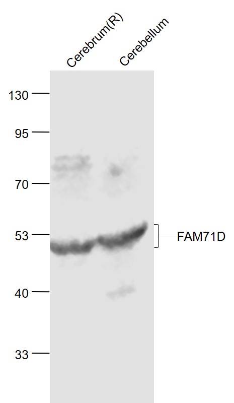 Lane 1: Rat Cerebrum lysates; Lane 2: Mouse Cerebrum lysates probed with FAM71D Polyclonal Antibody, Unconjugated (bs-11008R) at 1:1000 dilution and 4˚C overnight incubation. Followed by conjugated secondary antibody incubation at 1:20000 for 60 min at 37˚C.