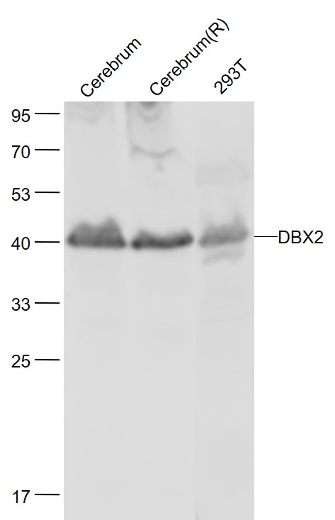 Lane 1: Mouse Cerebrum lysates; Lane 2: Rat Cerebrum lysates; Lane 3: Human 293T cell lysates probed with DBX2 Polyclonal Antibody, Unconjugated (bs-12149R) at 1:1000 dilution and 4˚C overnight incubation. Followed by conjugated secondary antibody incubation at 1:20000 for 60 min at 37˚C.