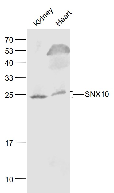 Lane 1: Mouse Kidney lysates; Lane 2: Mouse Heart lysates probed with SNX10 Polyclonal Antibody, Unconjugated (bs-12408R) at 1:1000 dilution and 4˚C overnight incubation. Followed by conjugated secondary antibody incubation at 1:20000 for 60 min at 37˚C.