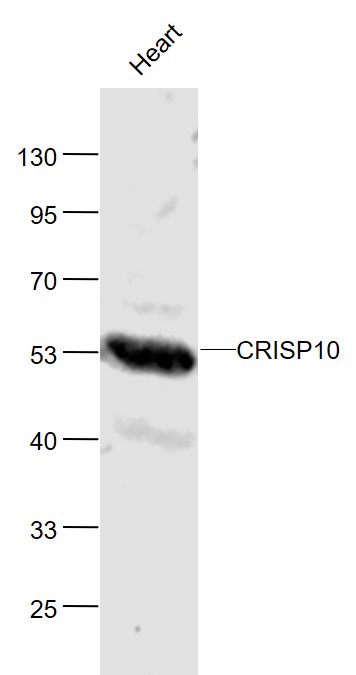 Lane 1: Mouse Heart lysates probed with CRISP10 Polyclonal Antibody, Unconjugated (bs-14060R) at 1:1000 dilution and 4˚C overnight incubation. Followed by conjugated secondary antibody incubation at 1:20000 for 60 min at 37˚C.