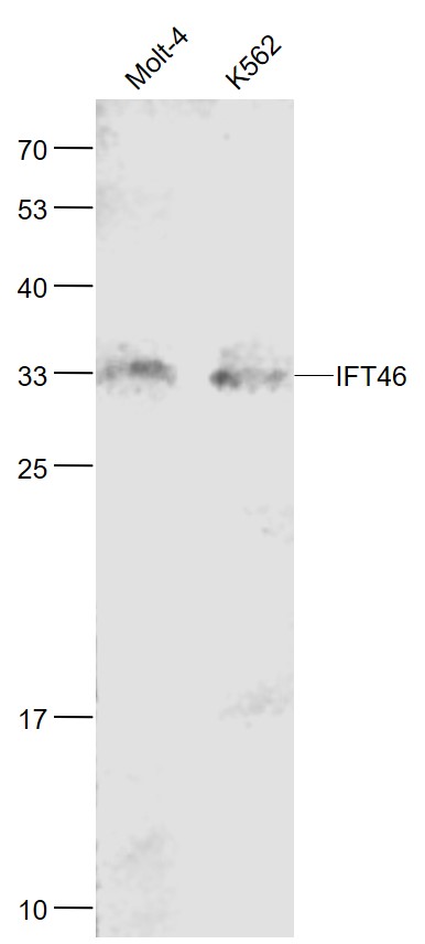 Lane 1: Human MOLT-4 cell lysates; Lane 2: Human K562 cell lysates probed with IFT46 Polyclonal Antibody, Unconjugated (bs-15563R) at 1:1000 dilution and 4˚C overnight incubation. Followed by conjugated secondary antibody incubation at 1:20000 for 60 min at 37˚C. Lane 1: Human MOLT-4 cell lysates; Lane 2: Human K562 cell lysates probed with IFT46 Polyclonal Antibody, Unconjugated (bs-15563R) at 1:1000 dilution and 4˚C overnight incubation. Followed by conjugated secondary antibody incubation at 1:20000 for 60 min at 37˚C.