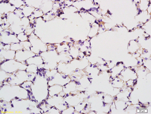 Formalin-fixed and paraffin embedded rat lung labeled with Anti PABP Polyclonal Antibody, Unconjugated (bs-3833R) at 1:200 followed by conjugation to the secondary antibody and DAB staining