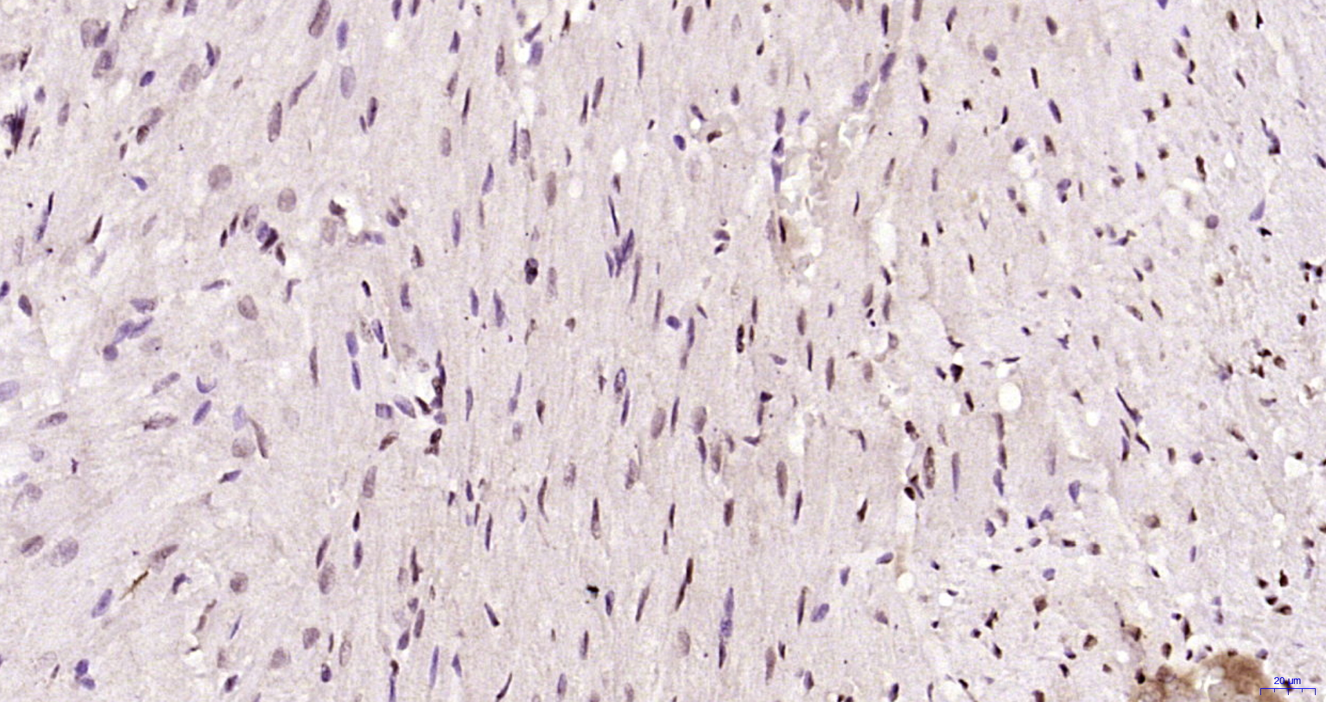 Paraformaldehyde-fixed, paraffin embedded Rat heart; Antigen retrieval by boiling in sodium citrate buffer (pH6.0) for 15min; Block endogenous peroxidase by 3% hydrogen peroxide for 20 minutes; Blocking buffer (normal goat serum) at 37°C for 30min; Antibody incubation with DNAPK/PRKDC Polyclonal Antibody, Unconjugated (bs-1359R) at 1:200 overnight at 4°C, DAB staining.