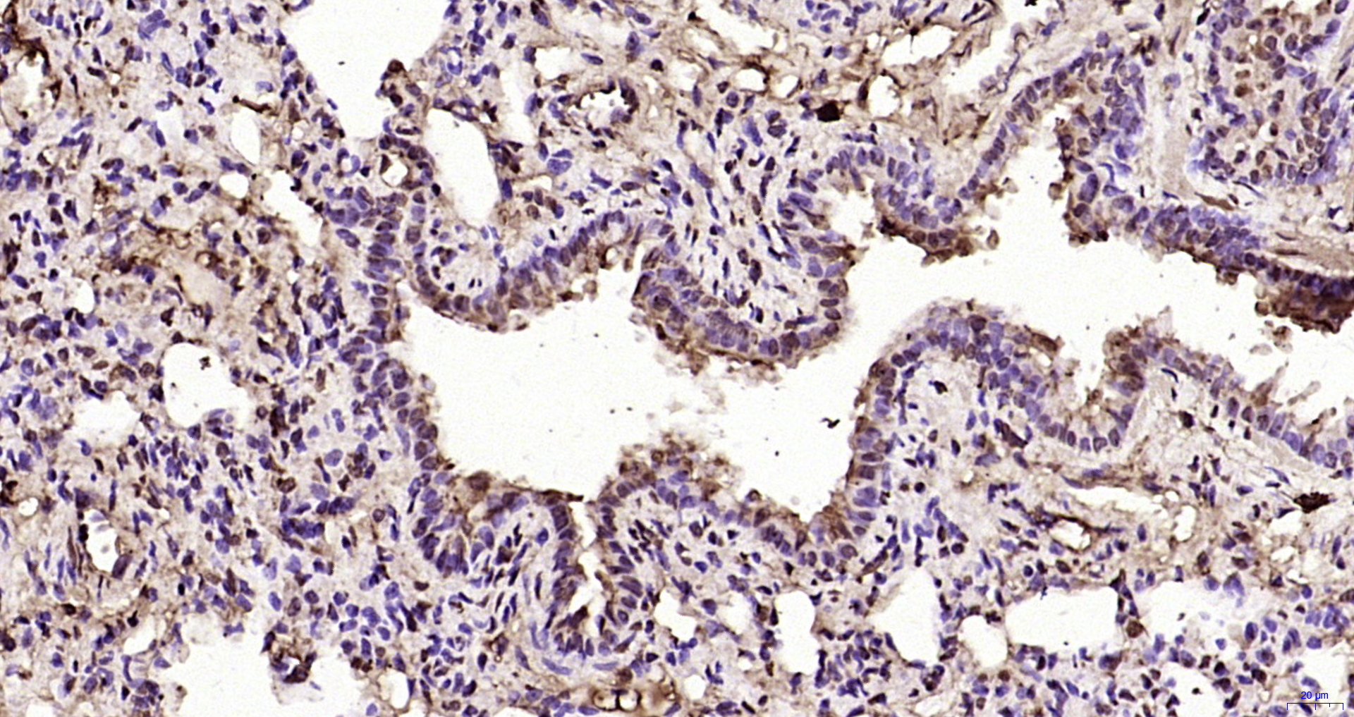 Paraformaldehyde-fixed, paraffin embedded Rat lung; Antigen retrieval by boiling in sodium citrate buffer (pH6.0) for 15min; Block endogenous peroxidase by 3% hydrogen peroxide for 20 minutes; Blocking buffer (normal goat serum) at 37°C for 30min; Antibody incubation with ATF4/CREB-2 Polyclonal Antibody, Unconjugated (bs-1531R) at 1:200 overnight at 4°C, DAB staining.