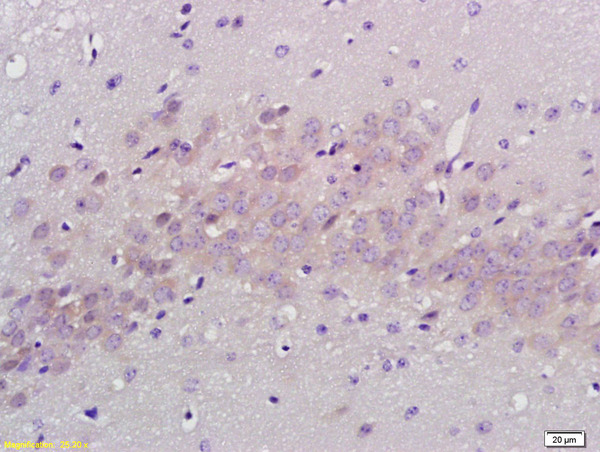 Formalin-fixed and paraffin embedded rat brain labeled with Anti PABP Polyclonal Antibody, Unconjugated (bs-3833R) at 1:200 followed by conjugation to the secondary antibody and DAB staining