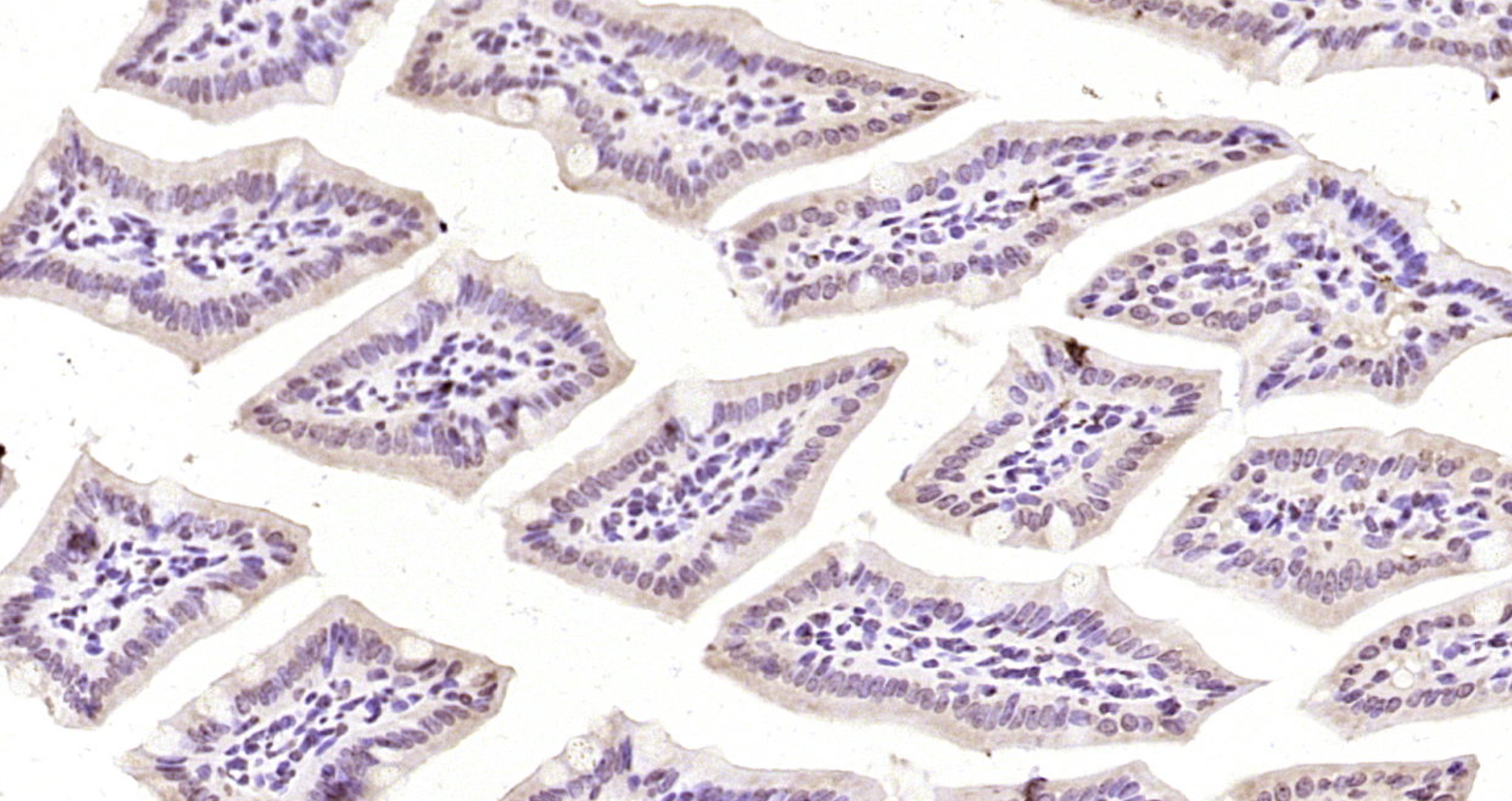 Paraformaldehyde-fixed, paraffin embedded Mouse intestine; Antigen retrieval by boiling in sodium citrate buffer (pH6.0) for 15min; Block endogenous peroxidase by 3% hydrogen peroxide for 20 minutes; Blocking buffer (normal goat serum) at 37°C for 30min; Antibody incubation with TNFAIP1 Polyclonal Antibody, Unconjugated (bs-2104R) at 1:200 overnight at 4°C, DAB staining.