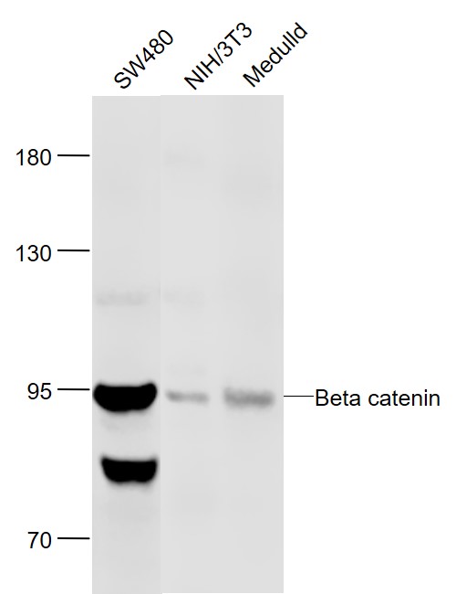 Lane 1: Human SW480 cell lysates; Lane 2: Mouse NIH/3T3 cell lysates; Lane 3: Mouse Medulld lysates probed with Beta catenin Polyclonal Antibody, Unconjugated (bs-23663R) at 1:1000 dilution and 4˚C overnight incubation. Followed by conjugated secondary antibody incubation at 1:20000 for 60 min at 37˚C.