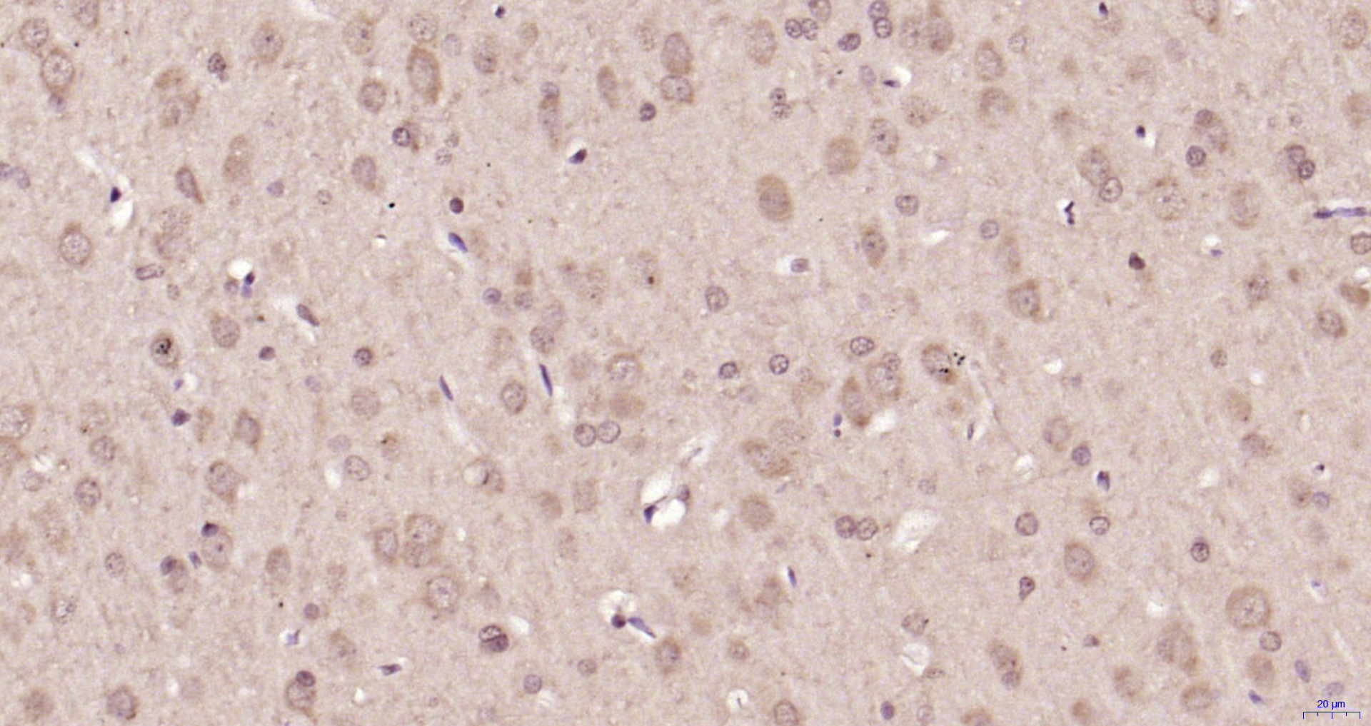 Paraformaldehyde-fixed, paraffin embedded Rat brain; Antigen retrieval by boiling in sodium citrate buffer (pH6.0) for 15min; Block endogenous peroxidase by 3% hydrogen peroxide for 20 minutes; Blocking buffer (normal goat serum) at 37°C for 30min; Antibody incubation with p38 MAPK (Thr180 + Tyr182) Polyclonal Antibody, Unconjugated (bs-2210R) at 1:200 overnight at 4°C, DAB staining.