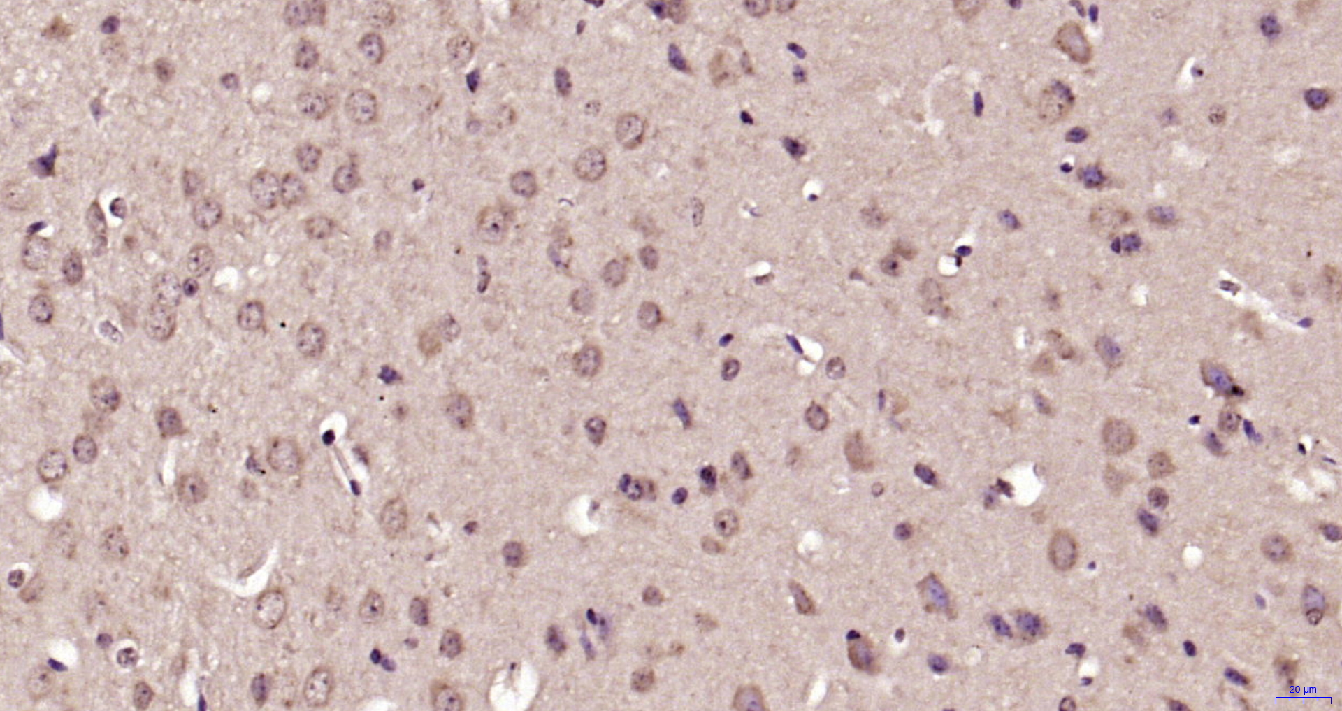 Paraformaldehyde-fixed, paraffin embedded Mouse brain; Antigen retrieval by boiling in sodium citrate buffer (pH6.0) for 15min; Block endogenous peroxidase by 3% hydrogen peroxide for 20 minutes; Blocking buffer (normal goat serum) at 37°C for 30min; Antibody incubation with p38 MAPK (Thr180 + Tyr182) Polyclonal Antibody, Unconjugated (bs-2210R) at 1:200 overnight at 4°C, DAB staining.