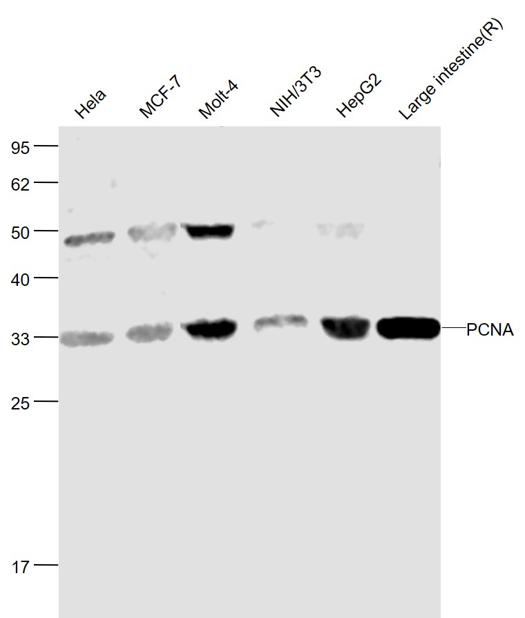 Lane 1: Human Hela cell lysates; Lane 2: Human MCF-7 cell lysates; Lane 3: Human MOLT-4 cell lysates; Lane 4: Mouse NIH/3T3 cell lysates; Lane 5: Human HepG2 cell lysates; Lane 6: Rat Large intestine lysates probed with PCNA Polyclonal Antibody, Unconjugated (bs-0754R) at 1:1000 dilution and 4˚C overnight incubation. Followed by conjugated secondary antibody incubation at 1:20000 for 60 min at 37˚C.