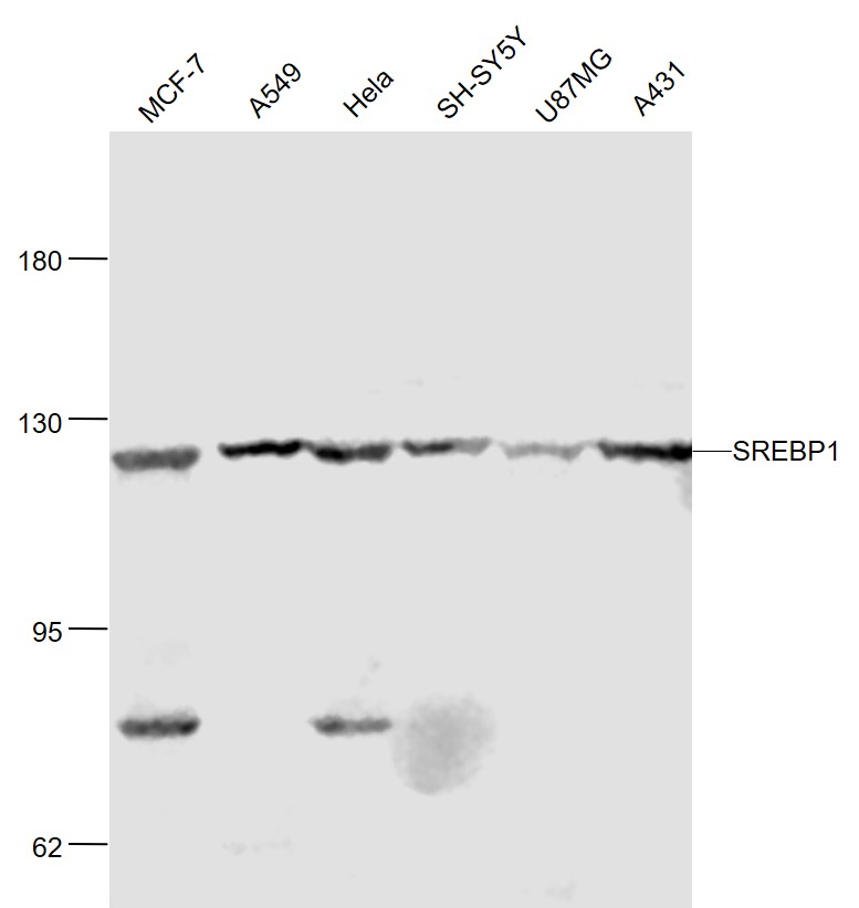 Lane 1: Human MCF-7 cell lysates; Lane 2: Human A549 cell lysates; Lane 3: Human Hela cell lysates; Lane 4: Human SH-SY5Y cell lysates; Lane 5: Human U-87MG cell lysates; Lane 6: Human A431 cell lysates probed with SREBP-1/2 Polyclonal Antibody, Unconjugated (bs-1402R) at 1:1000 dilution and 4˚C overnight incubation. Followed by conjugated secondary antibody incubation at 1:20000 for 60 min at 37˚C.