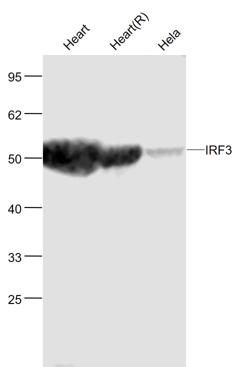 Lane 1: Mouse Heart lysates; Lane 2: Rat Heart lysates; Lane 3: Human Hela cell lysates probed with IRF3 Polyclonal Antibody, Unconjugated (bs-2993R) at 1:1000 dilution and 4˚C overnight incubation. Followed by conjugated secondary antibody incubation at 1:20000 for 60 min at 37˚C.