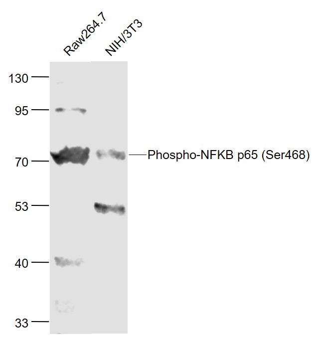 Lane 1: Mouse RAW264.7 cell lysates; Lane 2: Mouse NIH/3T3 cell lysates probed with NFKB p65 Polyclonal Antibody, Unconjugated (bs-3485R) at 1:1000 dilution and 4˚C overnight incubation. Followed by conjugated secondary antibody incubation at 1:20000 for 60 min at 37˚C