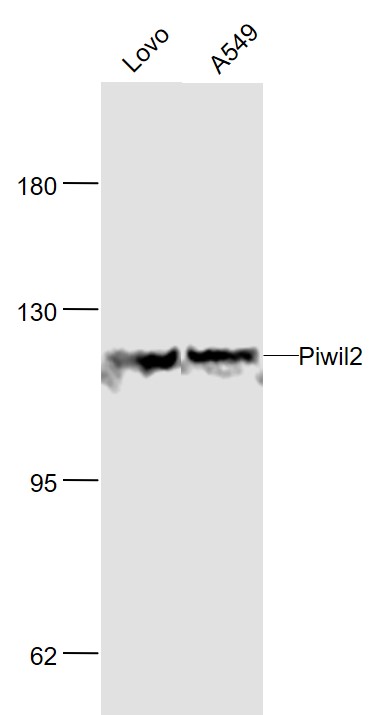 Lane 1: Human LOVO cell lysates; Lane 2: Human A549 cell lysates probed with Piwil/Mili Polyclonal Antibody, Unconjugated (bs-3817R) at 1:1000 dilution and 4˚C overnight incubation. Followed by conjugated secondary antibody incubation at 1:20000 for 60 min at 37˚C