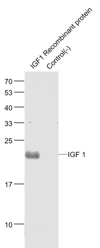 Lane 1: IGF1 Recombinat Protein lysates; Lane 2: Contro(-) lysates probed with IGF 1 Polyclonal Antibody, Unconjugated (bs-4588R) at 1:1000 dilution and 4˚C overnight incubation. Followed by conjugated secondary antibody incubation at 1:20000 for 60 min at 37˚C