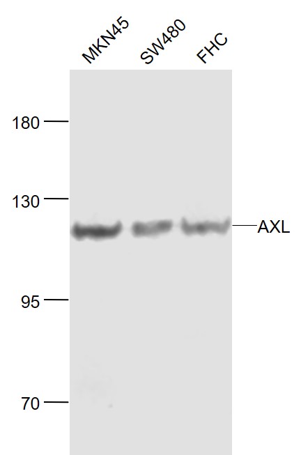 Lane 1: Human MKN45 cell lysates; Lane 2: Human SW480 cell lysates; Lane 3: Human FHC cell lysates probed with AXL Polyclonal Antibody, Unconjugated (bs-5180R) at 1:1000 dilution and 4˚C overnight incubation. Followed by conjugated secondary antibody incubation at 1:20000 for 60 min at 37˚C.