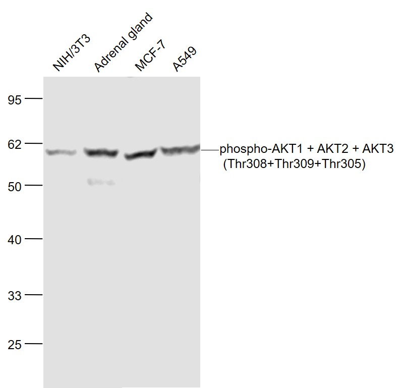 Lane 1: Mouse NIH/3T3 cell lysates; Lane 2: Mouse Adrenal gland lysates; Lane 3: Human MCF-7 cell lysates; Lane 4: Human A549 cell lysates probed with AKT1/2/3 Polyclonal Antibody, Unconjugated (bs-5182R) at 1:1000 dilution and 4˚C overnight incubation. Followed by conjugated secondary antibody incubation at 1:20000 for 60 min at 37˚C.