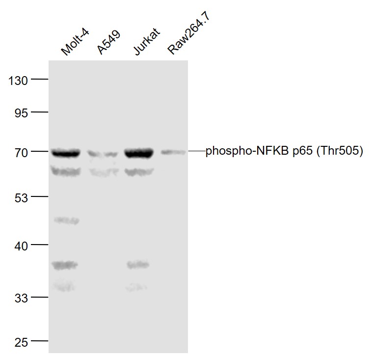 Lane 1: Human MOLT-4 cell lysates; Lane 2: Human A549 cell lysates; Lane 3: Human Jurkat cell lysates; Lane 4: Human RAW264.7 cell lysates probed with NFKB p65 Polyclonal Antibody, Unconjugated (bs-5663R) at 1:1000 dilution and 4˚C overnight incubation. Followed by conjugated secondary antibody incubation at 1:20000 for 60 min at 37˚C.