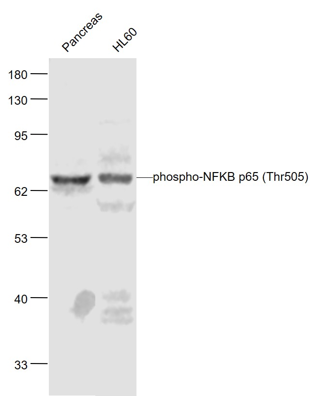 Lane 1: Mouse Pancreas lysates; Lane 2: Human HL-60 cell lysates probed with NFKB p65 Polyclonal Antibody, Unconjugated (bs-5663R) at 1:1000 dilution and 4˚C overnight incubation. Followed by conjugated secondary antibody incubation at 1:20000 for 60 min at 37˚C.