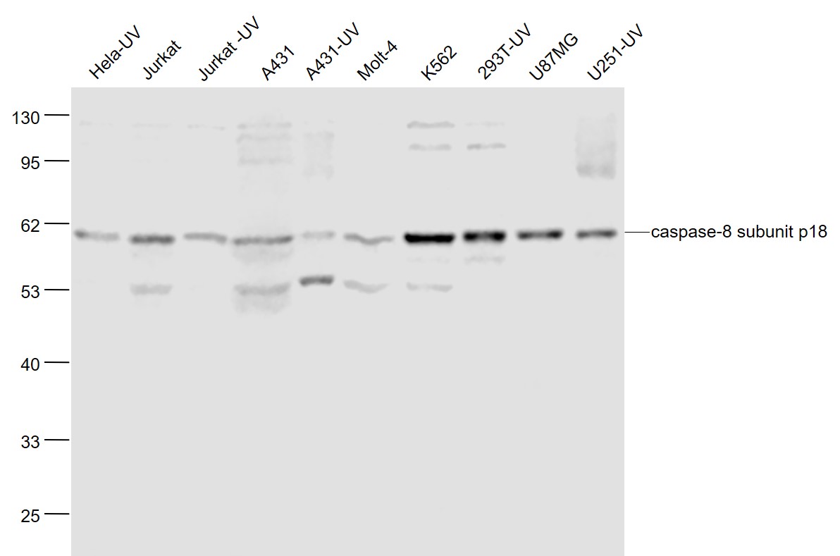 Lane 1: Human Hela-UV cell lysates; Lane 2: Human Jurkat cell lysates; Lane 3: Human Jurkat-UV cell lysates; Lane 4: Human A431 cell lysates; Lane 5: Human A431-UV cell lysates; Lane 6: Human MOLT-4 cell lysates; Lane 7: Human K562 cell lysates; Lane 8: Human 293T-UV cell lysates; Lane 9: Human U-87MG cell lysates; Lane 10: Human U251-UV cell lysates probed with Caspase-8 subunit p18 Polyclonal Antibody, Unconjugated (bs-6463R) at 1:1000 dilution and 4˚C overnight incubation. Followed by conjugated secondary antibody incubation at 1:20000 for 60 min at 37˚C.