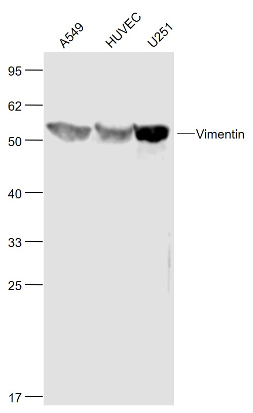 Lane 1: Human A549 cell lysates; Lane 2: Human HUVEC cell lysates; Lane 3: Human U251 cell lysates probed with Vimentin Polyclonal  Antibody, Unconjugated (bs-8533R) at 1:1000 dilution and 4˚C overnight incubation. Followed by conjugated secondary antibody incubation at 1:20000 for 60 min at 37˚C.