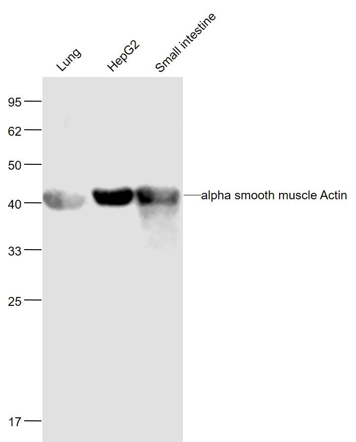 Lane 1: Mouse Lung lysates; Lane 2: Human HepG2 cell lysates; Lane 3: Mouse Small intestine lysates probed with Pan-Actin Polyclonal Antibody, Unconjugated (bs-10196R) at 1:1000 dilution and 4˚C overnight incubation. Followed by conjugated secondary antibody incubation at 1:20000 for 60 min at 37˚C.